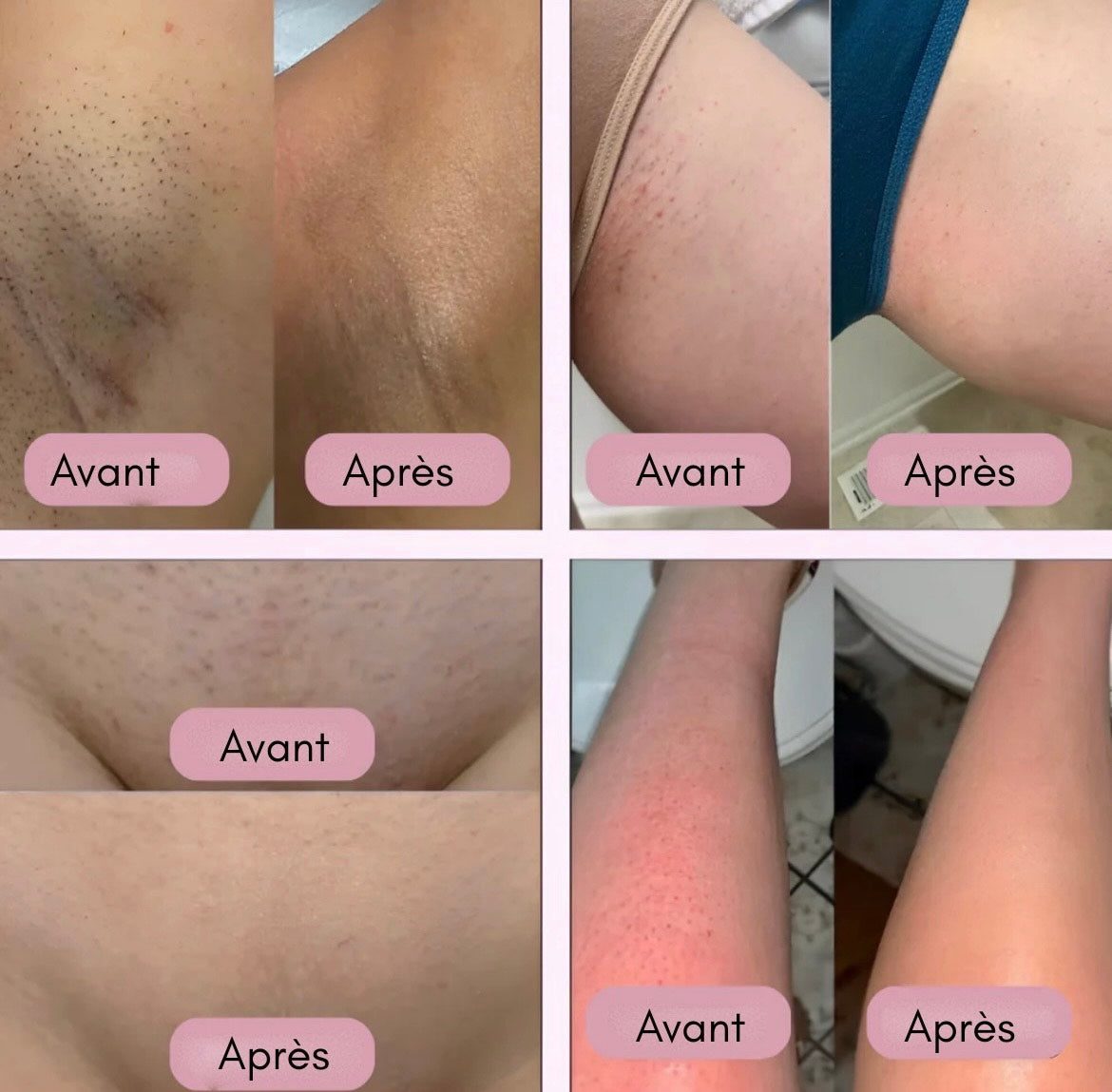 Kit GlissePro : rasoir + 2 têtes + gant exfoliant