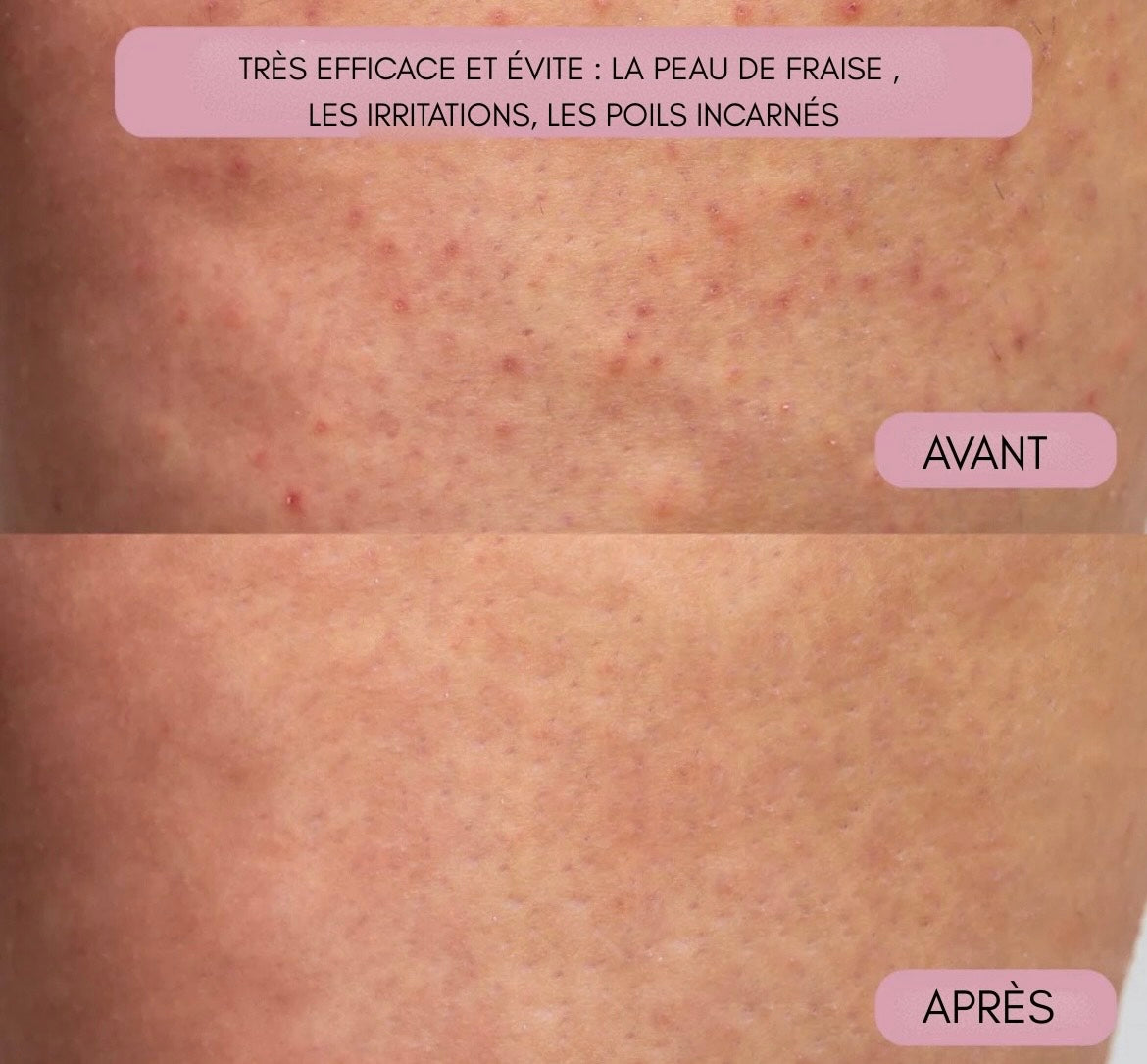Kit GlissePro : rasoir + 2 têtes + gant exfoliant