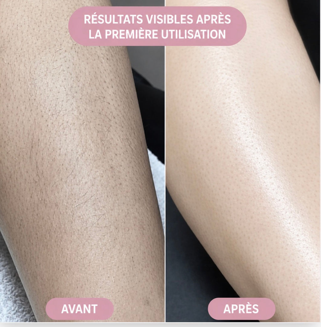 LUNARA PRO épilateur définitif